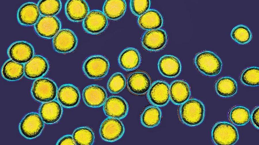 dd5425b0bac49cdb79407f91eff466d5