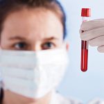 Новый анализ крови может обнаруживать прионы