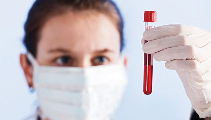 Новый анализ крови может обнаруживать прионы