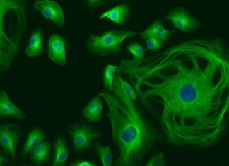 Учёные выявили ранее неизвестные причины запуска иммунной системы человека при красной волчанке