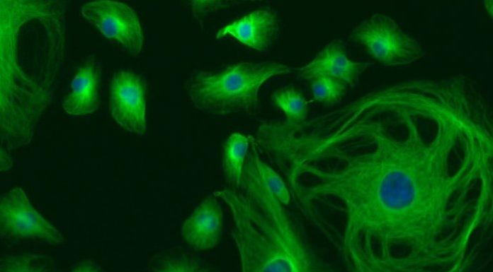 Учёные выявили ранее неизвестные причины запуска иммунной системы человека при красной волчанке