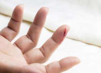 Почему антисептики «жгут» при обработке ран?