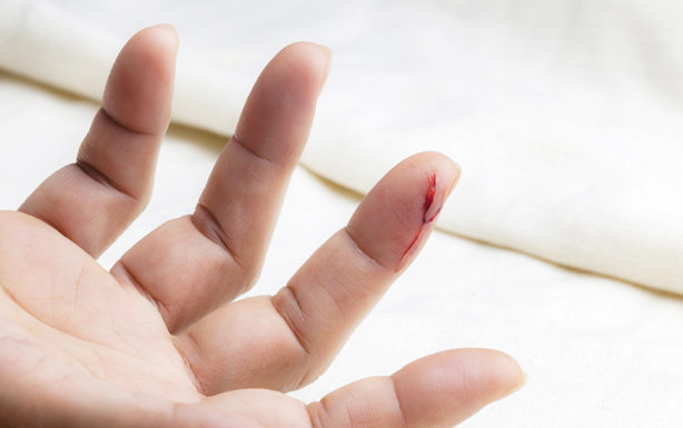 Почему антисептики «жгут» при обработке ран?