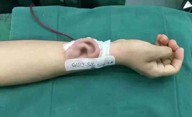 Китайские хирурги вырастили ухо