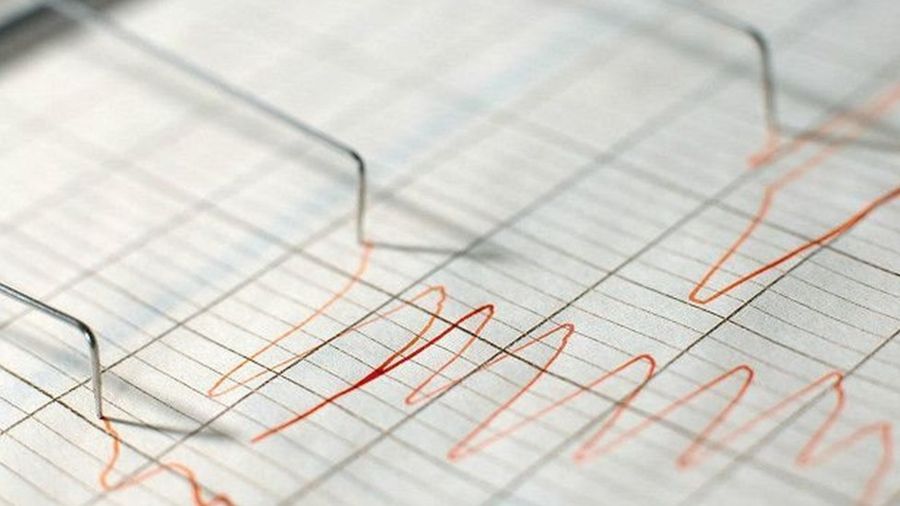 dada30fd4b508a9cd4989e83be97dbf2