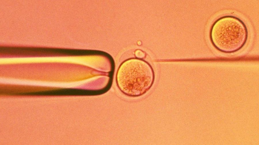 8558dfc65b4b397fc283baaf744bb60e