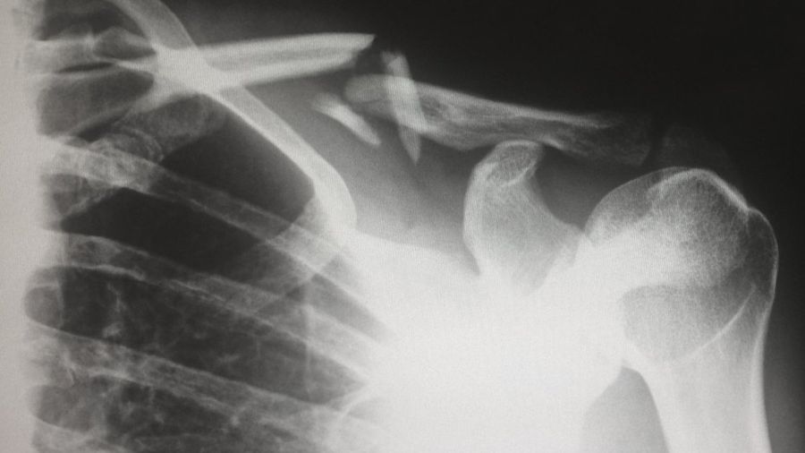 b54f8d885a1048212c797b77f0381576