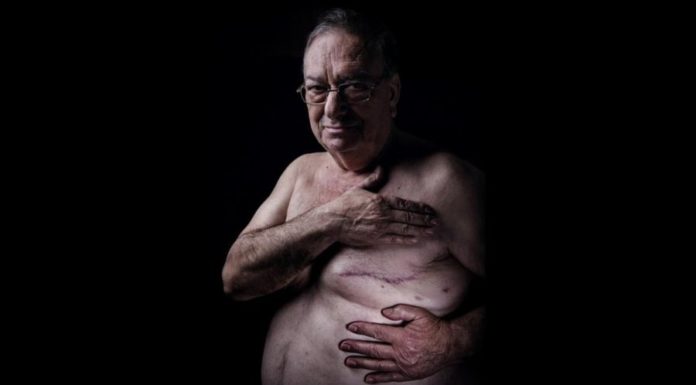 Почему гены рака молочной железы так же опасны для мужчин