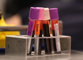 Ученые оживили органы свиньи через час после смерти. Что значит это открытие для медицины