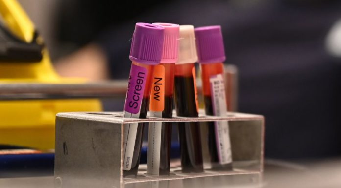 Ученые оживили органы свиньи через час после смерти. Что значит это открытие для медицины