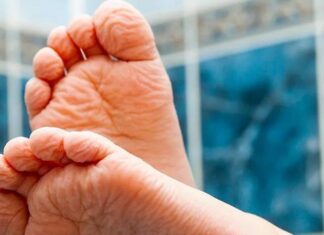 Что морщины из воды могут рассказать о вашем здоровье