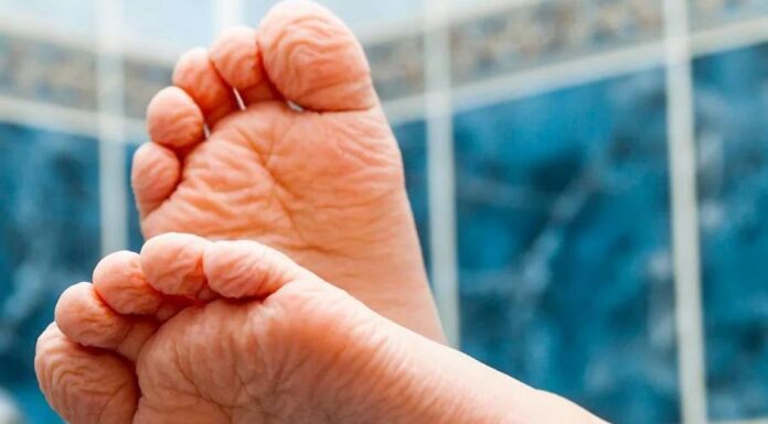 Что морщины из воды могут рассказать о вашем здоровье