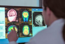 Ученые удивились, что молодость продолжается даже после 30 лет. Как это объяснили пятью этапами развития в мозгу