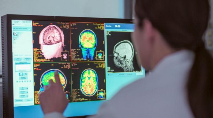 Ученые удивились, что молодость продолжается даже после 30 лет. Как это объяснили пятью этапами развития в мозгу