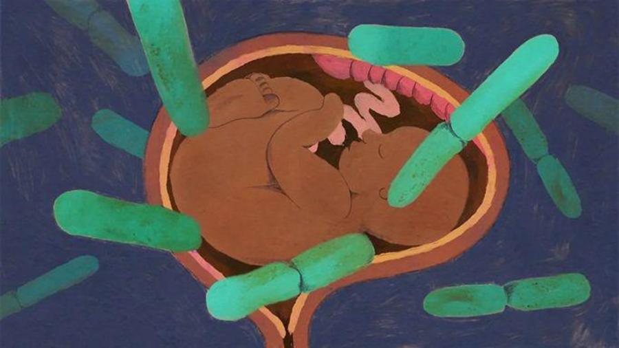 Как микробы во влагалище защищают здоровье и увеличивают шансы на беременность 2 a9875ba9a721dd254c0d41ced751bbcd